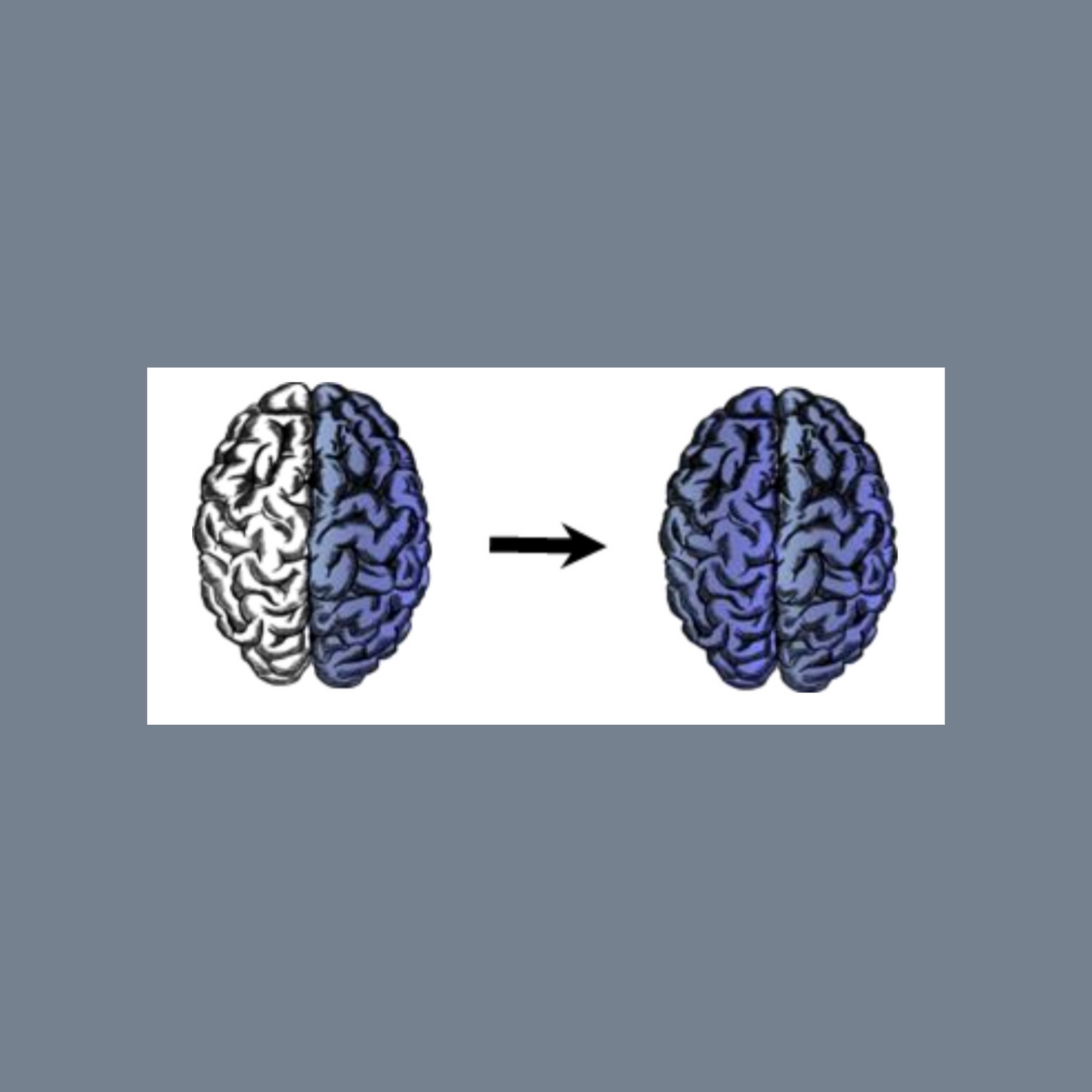 NAP+ Advanced & Brain Agility Booster Course - Adults